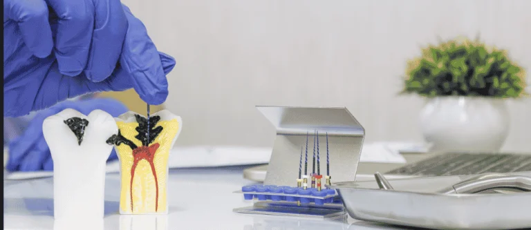 AI root canal infection detection