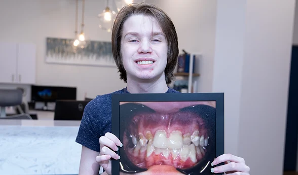 Restorative dentistry patient holding his before photo in a video testimonial
