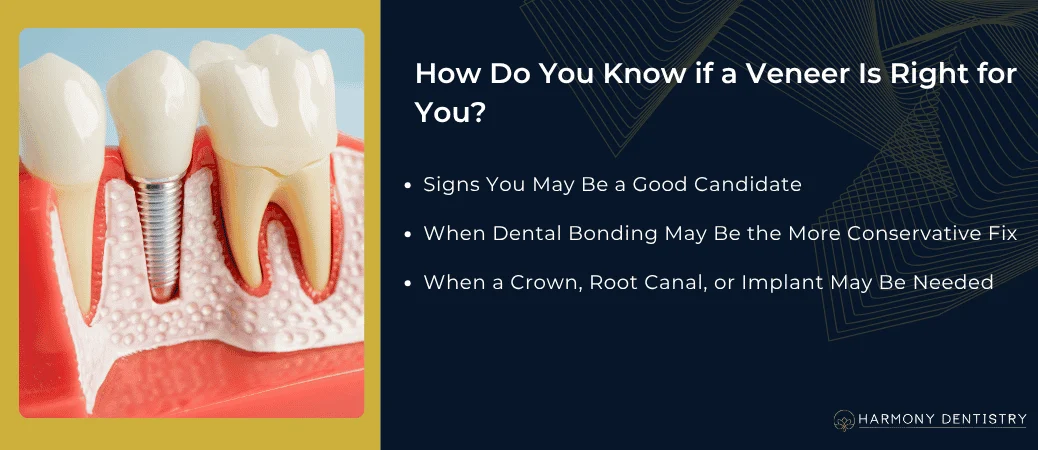 When Is a Veneer the Right Choice