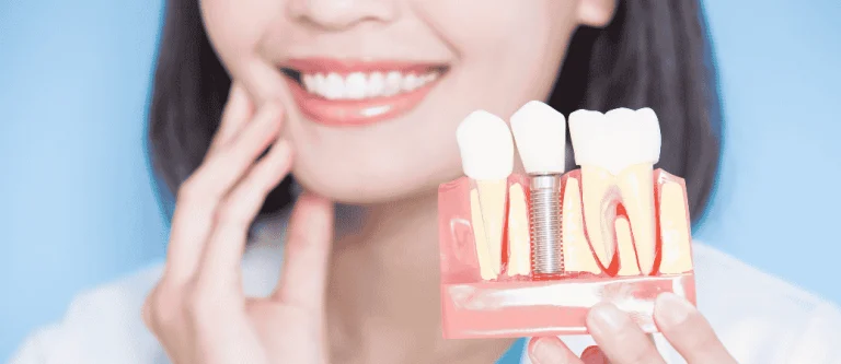 dental implants after years of missing teeth