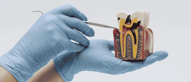 root canal vs tooth extraction