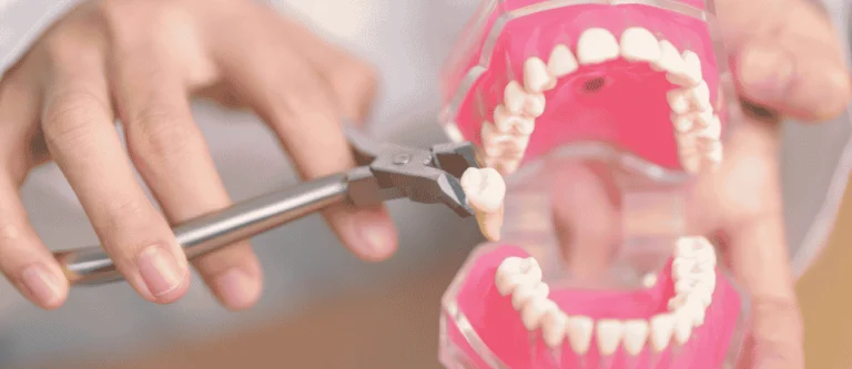tooth extraction Fortville IN